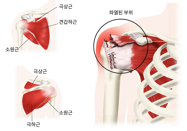 활기찬신경외과