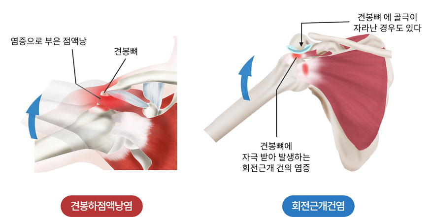 활기찬신경외과