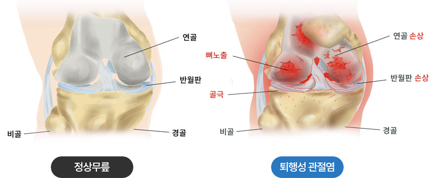 활기찬신경외과