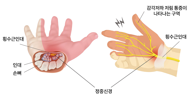 활기찬신경외과