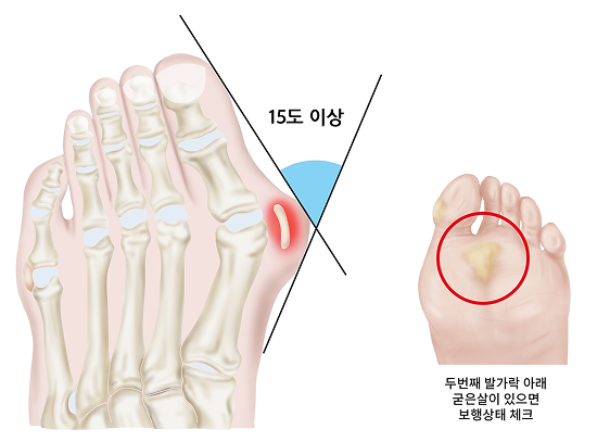 활기찬신경외과
