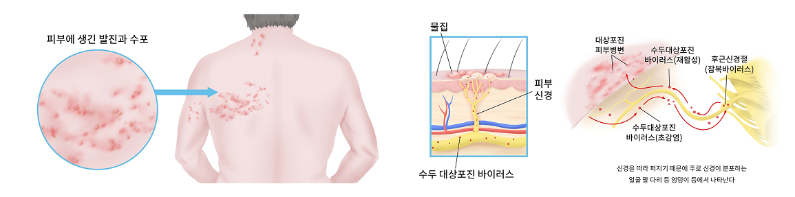 활기찬신경외과
