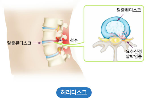 활기찬신경외과