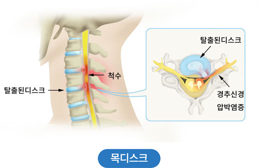 활기찬신경외과