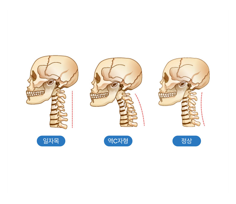 활기찬신경외과