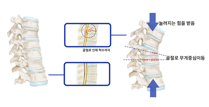 활기찬신경외과