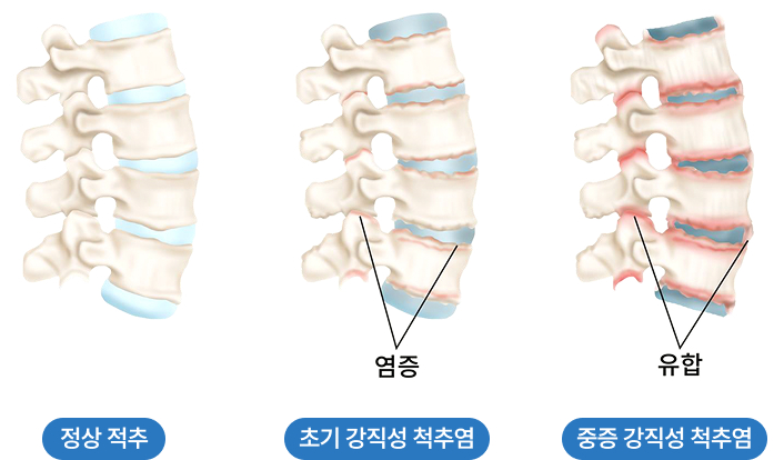 활기찬신경외과