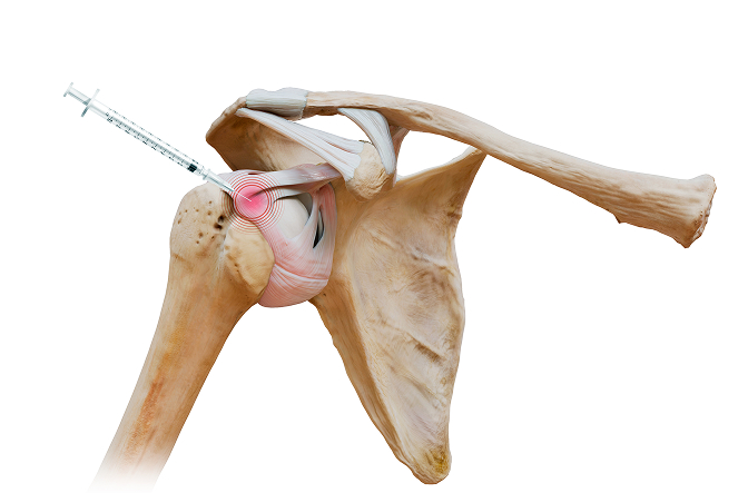 활기찬신경외과