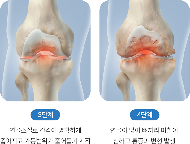 활기찬신경외과