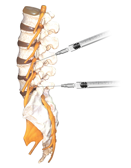 활기찬신경외과