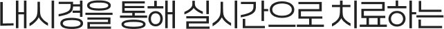 내시경을 통해 실시간으로 치료하는